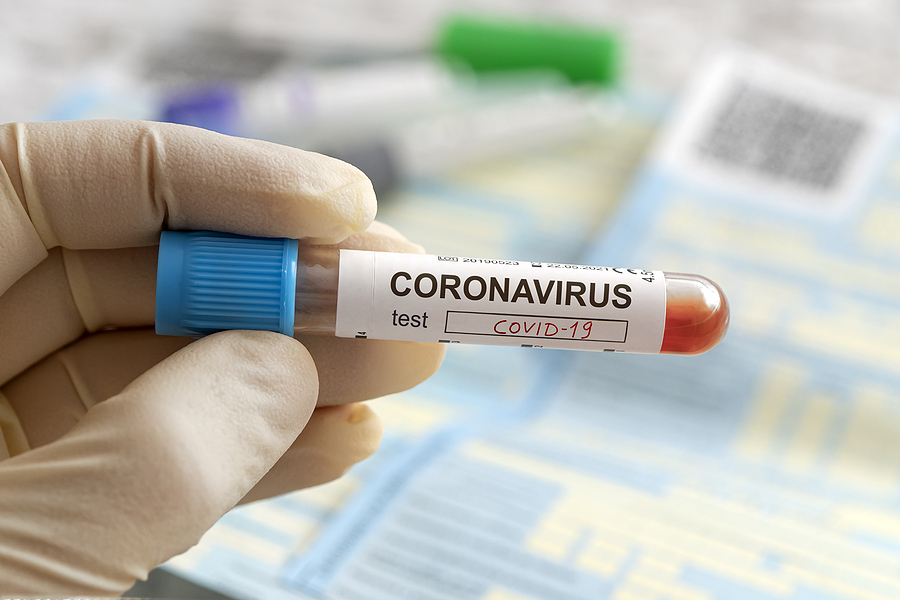 What is a Coronavirus? Are Coronavirus and COVID-19 the same?